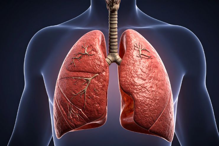 How Fast Lung Cancer Grows