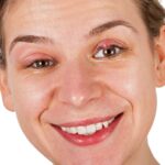 Is a stye contagious