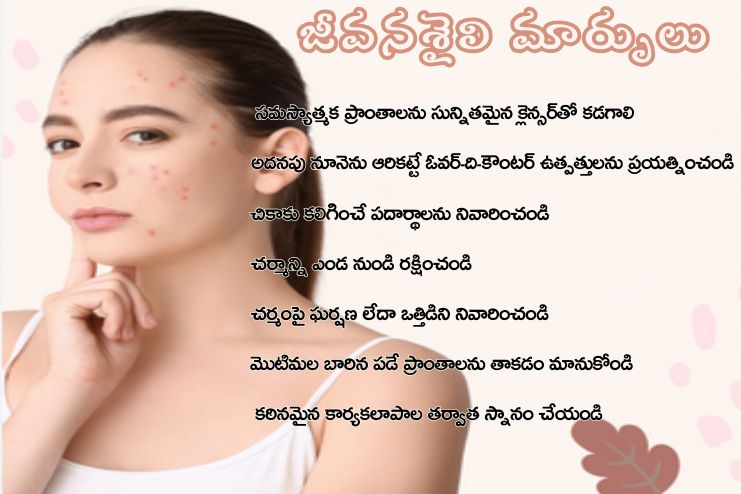 Lifestyle and home remedies