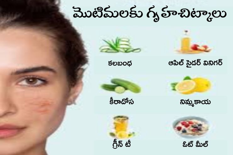 Lifestyle and home remedies 2