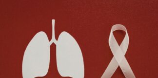 ఊపిరితిత్తుల క్యాన్సర్: పురోగతి, మరియు చికిత్స - Lung Cancer: progression, doubling time and treatment Lung Cancer_ progression, doubling time and treatment 2