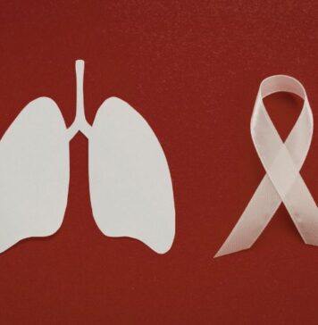 ఊపిరితిత్తుల క్యాన్సర్: పురోగతి, మరియు చికిత్స Lung Cancer_ progression, doubling time and treatment 2