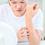 Protect your skin from rashes