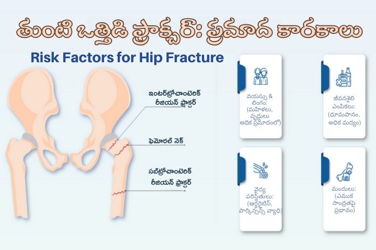 Risk Factors of Hip Fracture