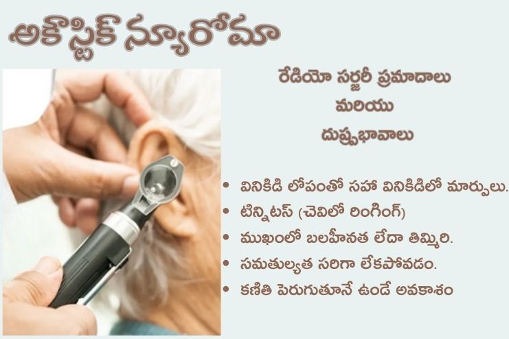 Risks and side effects of radiosurgery