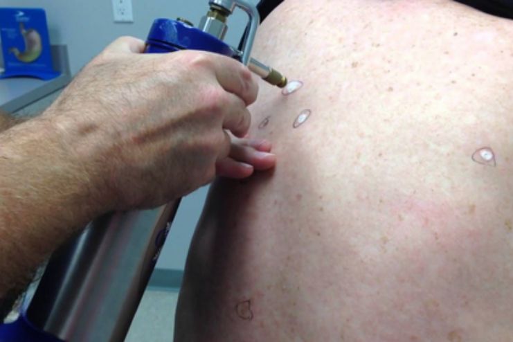 Surgical and other procedures