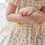 Viral infections that spread during summer