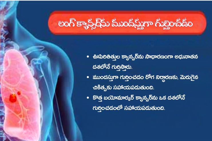 When Can Lung Cancer First Be Detected