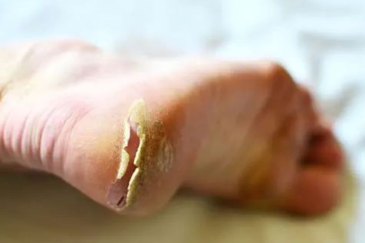 When to Seek Professional Help