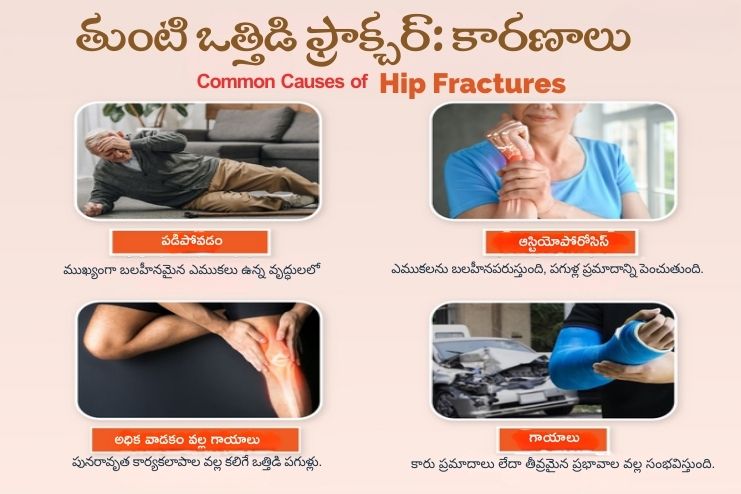 causes of HIP stress fracture