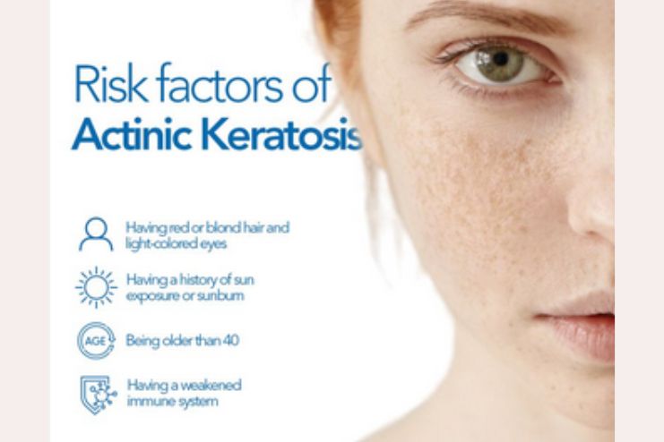 risk factors of AK
