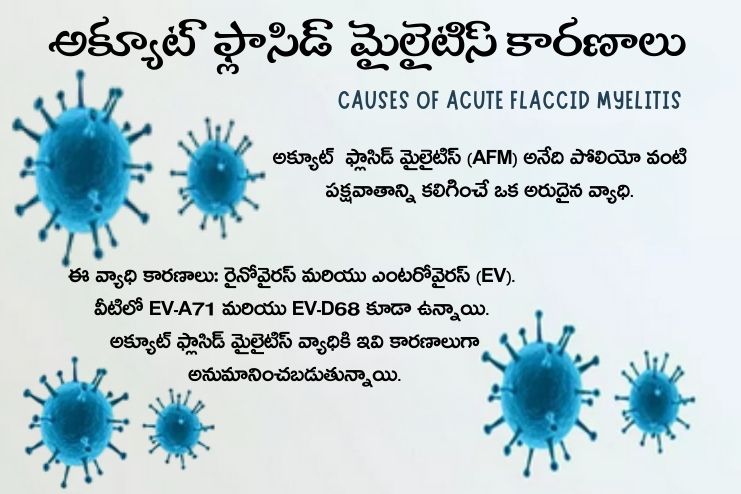 CAUSES OF ACUTE FLACCID MYELITIS
