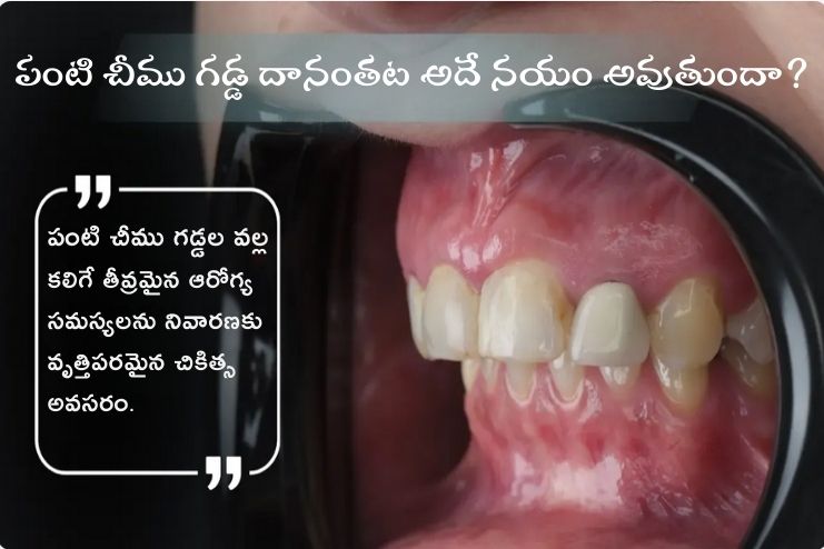 Can a tooth abscess go away by itself