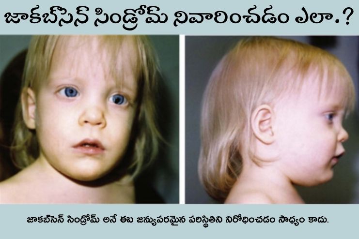 How can I prevent Jacobsen syndrome