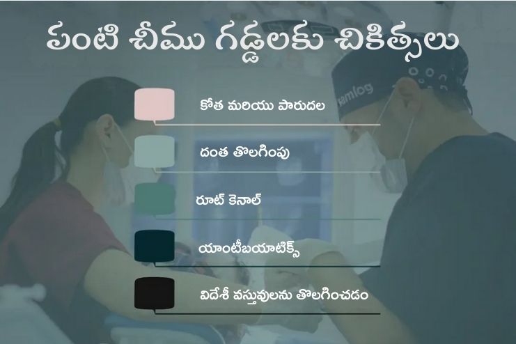 How do you treat a tooth abscess