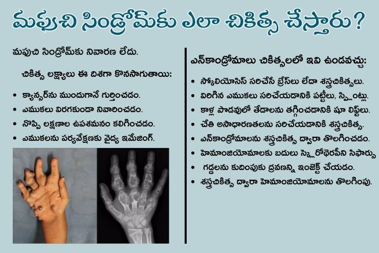 How is Maffucci syndrome treated