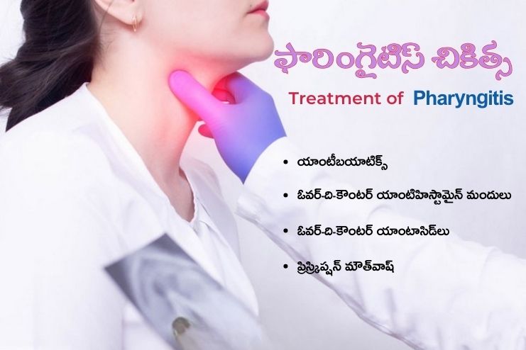 How is pharyngitis treated