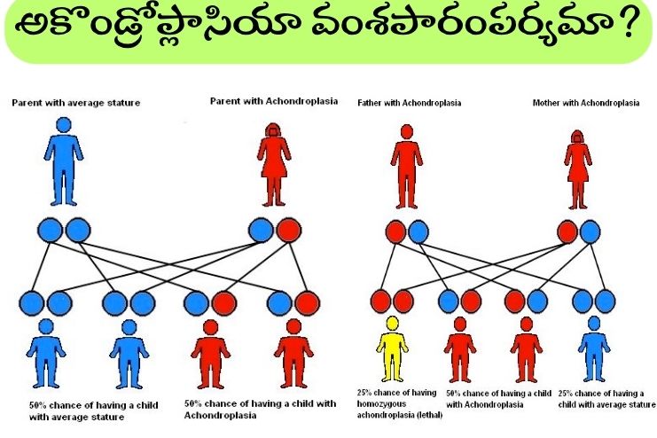 Is achondroplasia hereditary