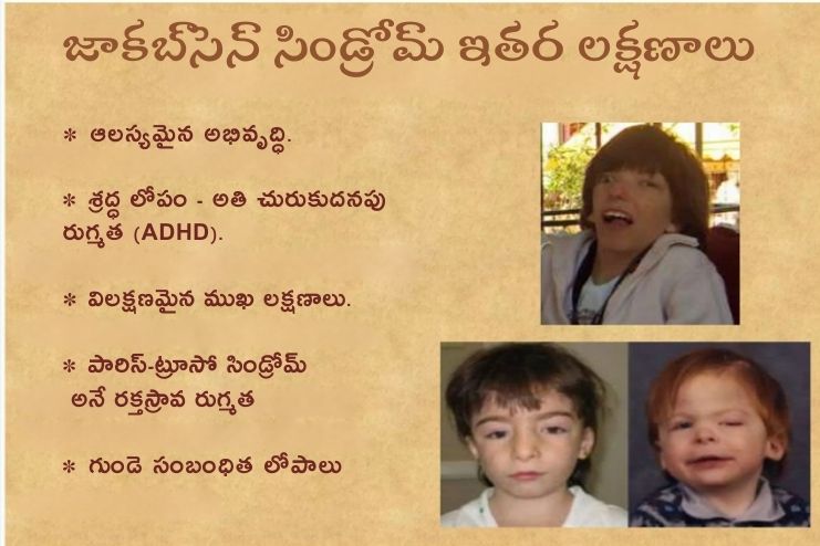 Jacobsen syndrome other symptoms