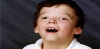 జాకబ్సెన్ సిండ్రోమ్: కారణాలు, లక్షణాలు, చికిత్స - Jacobsen syndrome: Causes, Symptoms and Treatment Jacobsen syndrome_ Causes, Symptoms and Treatment