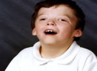 జాకబ్సెన్ సిండ్రోమ్: కారణాలు, లక్షణాలు, చికిత్స Jacobsen syndrome_ Causes, Symptoms and Treatment