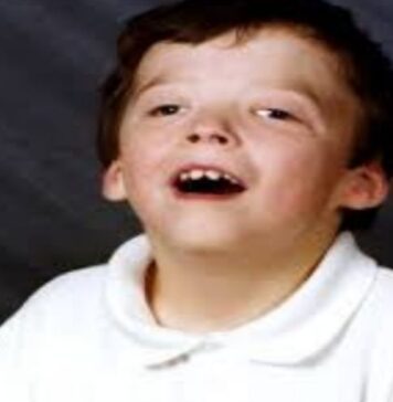 జాకబ్సెన్ సిండ్రోమ్: కారణాలు, లక్షణాలు, చికిత్స Jacobsen syndrome_ Causes, Symptoms and Treatment