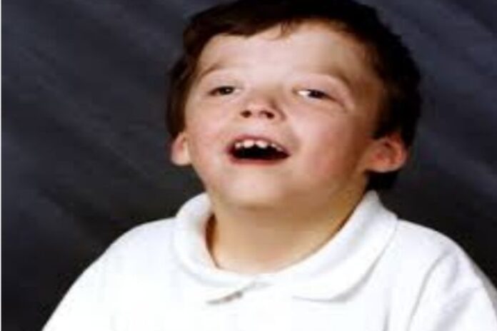 Jacobsen syndrome_ Causes, Symptoms and Treatment