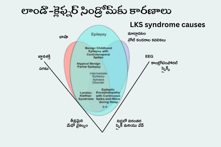 LKS syndrome causes