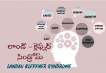 లాండౌ క్లెఫ్నర్ సిండ్రోమ్: కారణాలు, లక్షణాలు, చికిత్స Landau-Kleffner Syndrome_ Symptoms, Causes, and Treatment