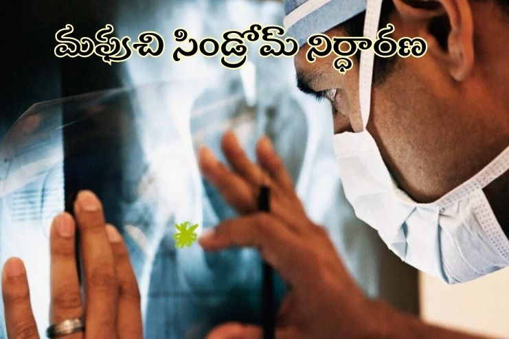 Maffucci syndrome diagnosis