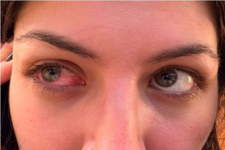 Outlook for this condition