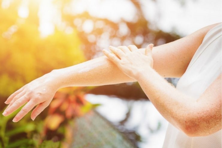 Sunlight and Skin Conditions