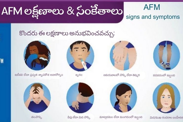 Symptoms of Acute Flaccid Myelitis