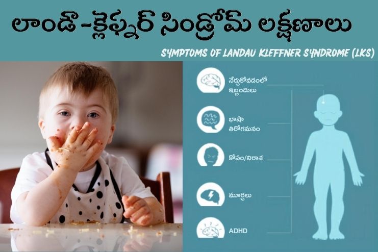 Symptoms of LKS syndrome
