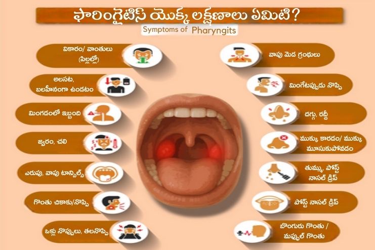 Symptoms of a pharyngitis