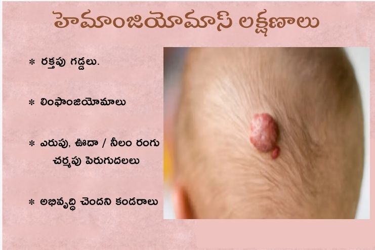 Symptoms related to hemangiomas