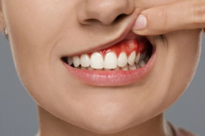 Tooth Abscess_ Causes, Symptoms and Treatment