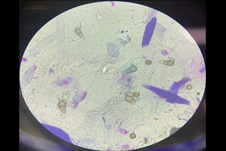 Understanding acanthamoeba