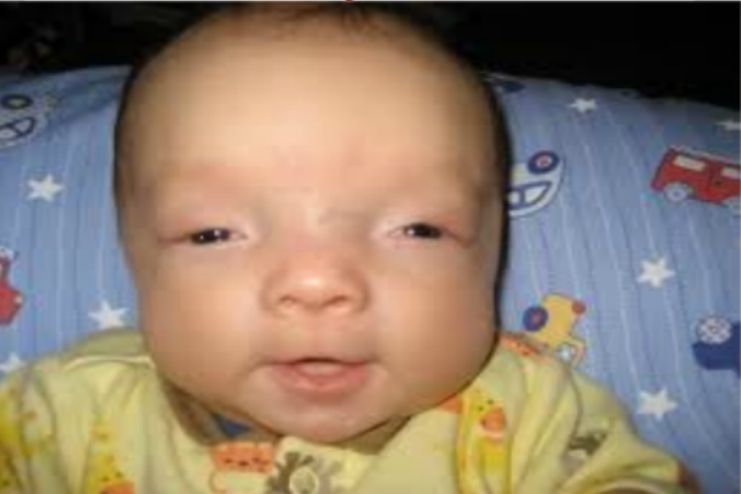 What can expect if my child has