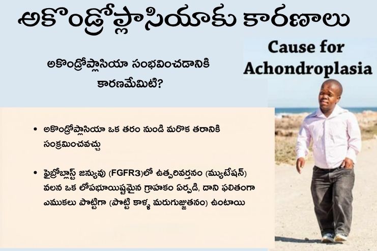 What causes achondroplasia (2)