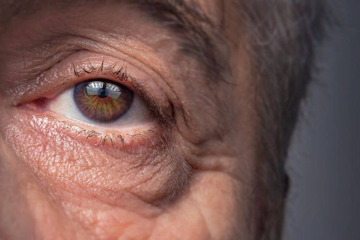 What is acanthamoeba keratitis