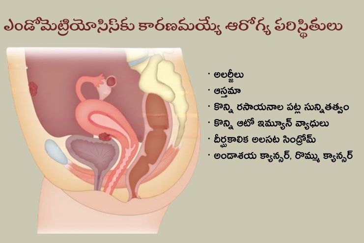 Causes and risk factors 3