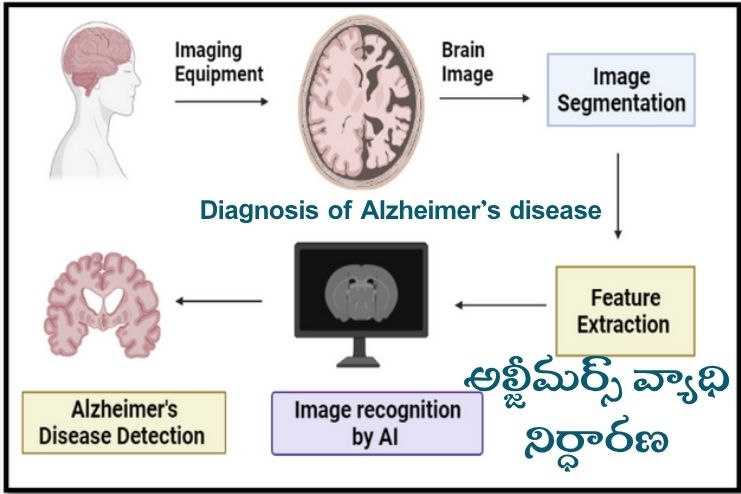 Diagnosis of Alzheimer’s disease