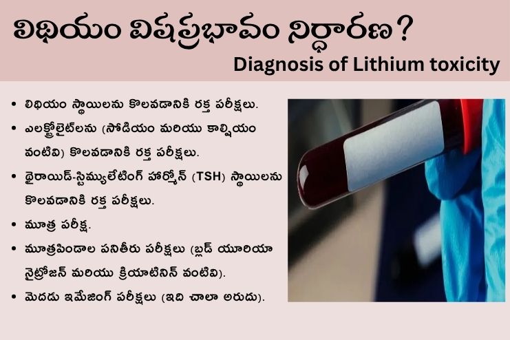 Diagnosis of Lithium toxicity