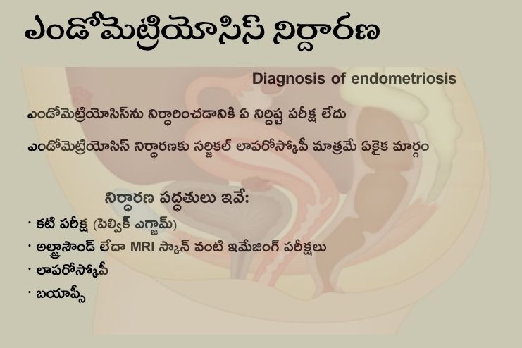 Diagnosis of endometriosis