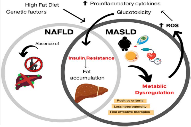 NAFLD Vs MASLD