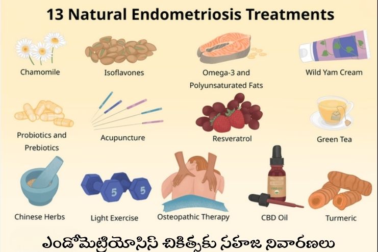 Natural remedies for endometriosis