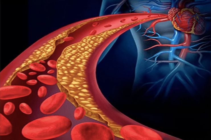 Positive effects on blood pressure, triglycerides 2