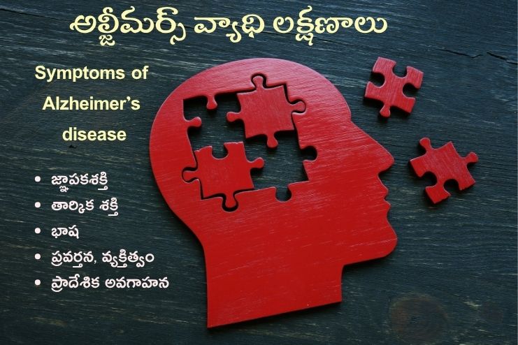 Symptoms of Alzheimer’s disease