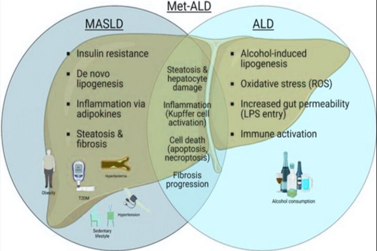 The New Sub-Category_ MetALD